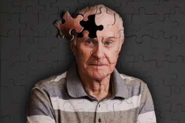 アルツハイマー病の傾向と対策
